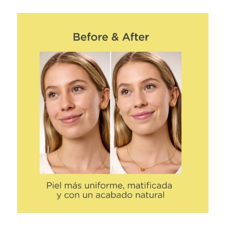 ACNIBEN CC+LIGHT CREAM 40ML